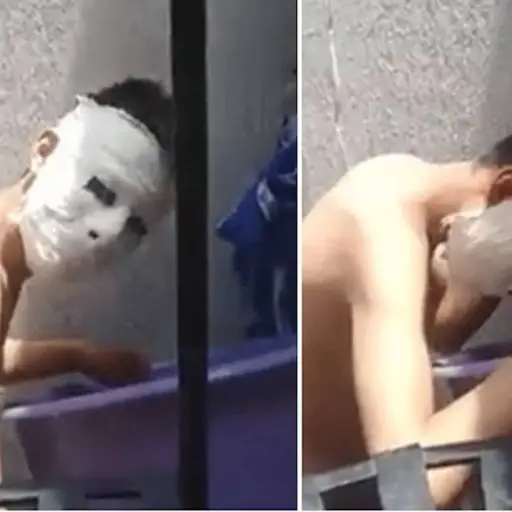 Estudiante-hace-mascara-de-yeso-para-un-proyecto-y-se-le-queda-pegada-.png ,