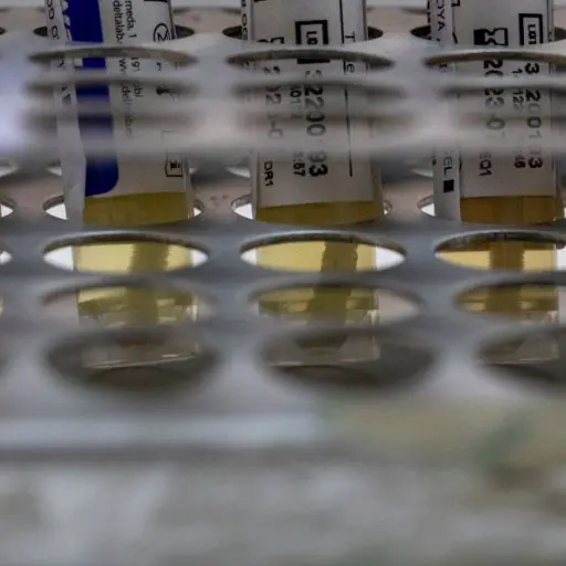 prueba-viruela-mono.jpg ,