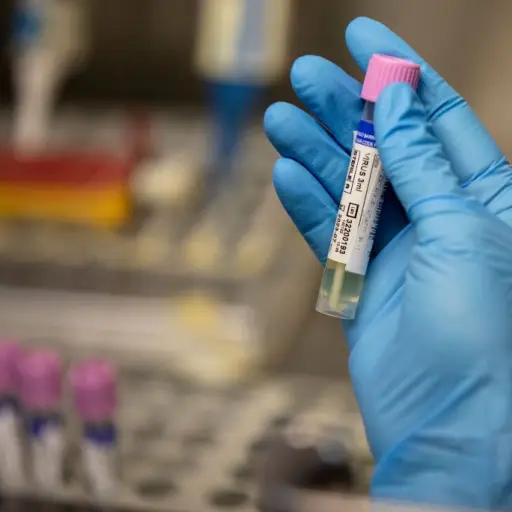 viruela-del-mono-guatemala-prevencion.jpg ,