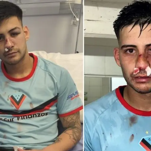 futbolista-argentino-recibe-patada-fuerte-en-el-rostro-agosto-2023-1.jpg ,