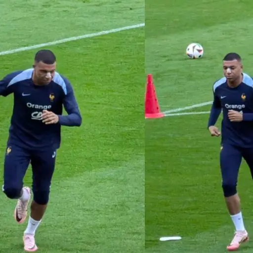 kylian-mbappe-lesion-nariz.webp ,