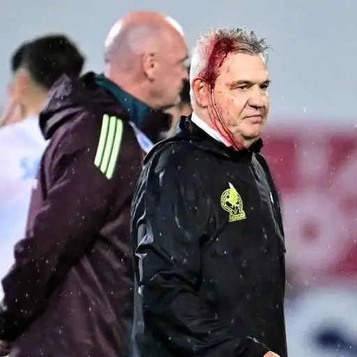 javier-aguirre-agresion.jpg ,