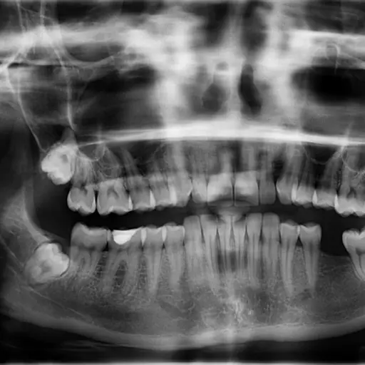 Radiografía dientes. Imagen de referencia.  ,Pixabay