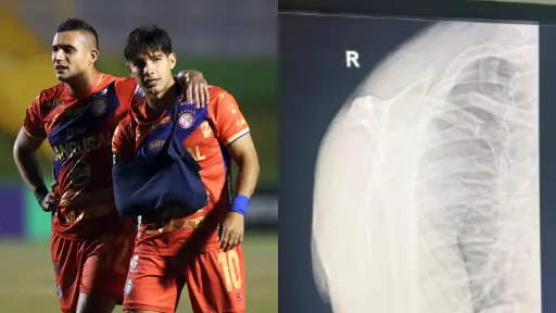 Jesús López sufrió una lesión en el hombro derecho durante el partido ante Firpo 